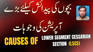 CAUSES OF LOWER SEGMENT CASERIAN SECTION LSCS C SECTION [upl. by Eob]