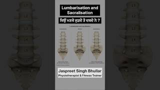 Sacralization and Lumbarization backpainrelief vertigo jassfitness shorts lowerbackpain gym [upl. by Berky]