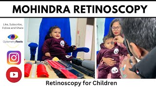 How to perform Mohindra Retinoscopy  Near Retinoscopy  Retinoscopy in Children optometryreels [upl. by Anailli]