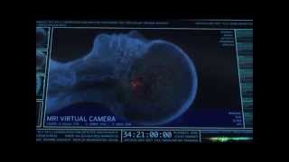 The Walking Dead Brain Scan Scene [upl. by Acherman233]