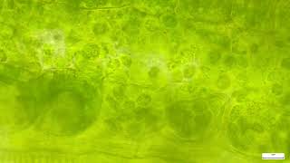 Leaf mesophyll and bundle sheath cells with chlorophyll and colonizing bacteria in C46 [upl. by Lalaj821]