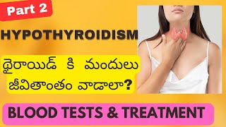 Hypothyroidism Low thyroidTests amp Treatment  How to Take Thyroid Medicine Dr SasapuTelugu [upl. by Melbourne]