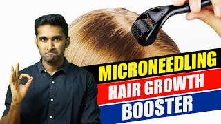 How to do MICRONEEDLING at home for HAIR GROWTHதமிழ் tamil haircare hairgrowth hairloss [upl. by Catlee392]