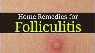 10 Home Remedies for Folliculitis and Best Home Treatment methods [upl. by Lilybel]