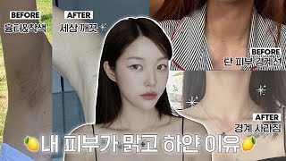 eng 언니 피부 어떻게 하얘졌어요🍋  찐으로 효과본 미백템들 겨드랑이 착색 관리템 탄 피부 되돌리는 법✨  소윤Soyoon [upl. by Tadeo]