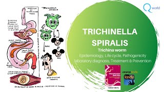 Trichinella Spiralis Parasitology simplified tutorials For NEXT USMLE NEET PG PLAB [upl. by Lednyk]