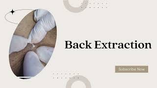 Back Facial Extraction In Action [upl. by Janna]