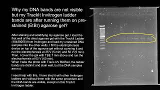 Gel electrophoresis faint bands [upl. by Levins581]