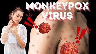 Monkeypox Virus Everything You Need to Know About the Current Outbreak [upl. by Avin824]