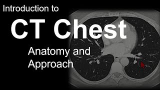 Introduction to CT Chest  Anatomy and Approach [upl. by Chuck]