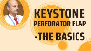 The Keystone perforator flap Basics [upl. by Valaria]