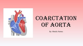 Coarctation of aorta  signs and symptoms CXR finding ECG echo management [upl. by Aicilas71]