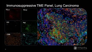 Myeloid Immunosuppression in the Tumor Microenvironment Characterized by SingleMultiplex IHC [upl. by Navonod786]