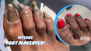 INTENSE FOOT MAKEOVER  PART 2 FINAL RESULT [upl. by Vanya917]