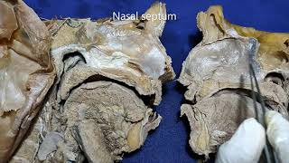 Nasal cavity and paranasal air sinuses [upl. by Graubert]