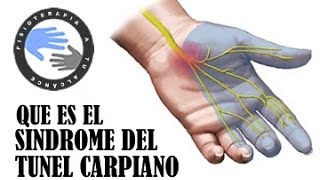 🥇 Anatomía del TÚNEL CARPIANO Límites Contenido Ligamentos [upl. by Lesab306]