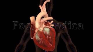 Atrial fibrillation  Animated Atlas [upl. by Senzer]