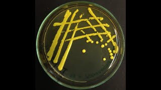 Micrococcus luteus  the most common cleanroom bacterium [upl. by Ing]