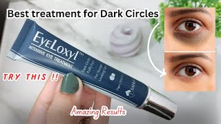 Eyeloxyl Eye Treatment  Best treatment for Dark circles [upl. by Araj]