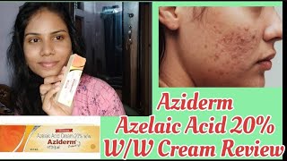 Aziderm Azelalic Acid Cream Review In Telugu  For Acne skincare azelaicacid skincareindia [upl. by Enaerb]