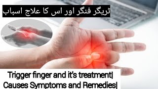 Trigger finger and its treatmentCauses Symptoms and RemediesDr hafiz Abdulsattar anjumUrduHindi [upl. by Reagen]