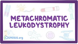 Metachromatic leukodystrophy  causes symptoms diagnosis treatment pathology [upl. by Ellenwad476]