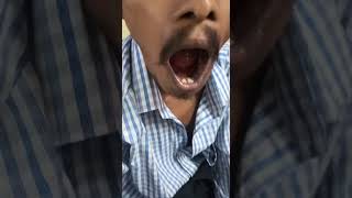 Tongue fibrillations in a case of Motor Neuron diseaseMND [upl. by Hsizan]