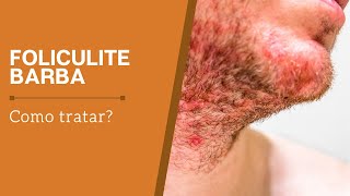 Foliculite de barba Como tratar a foliculite na barba [upl. by Ahsirt811]