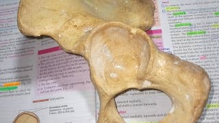 Acetabulum and Obturator foramen Human Anatomy [upl. by Wakefield]