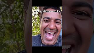 Maxilar quebrado kkkk meuzalunos humor [upl. by Ordnasil]