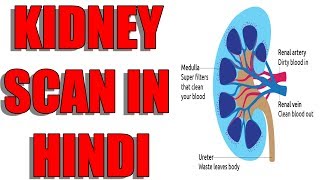 KIDNEY SCAN IN HINDI  किडनी स्कैन इन हिंदी  RENAL SCAN IN HINDI  Medical Guruji [upl. by Nuawd]