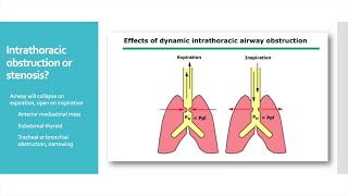 Anesthesia Considerations in the Narrowed Airway Jet Ventilation and Rigid Bronchoscopy [upl. by Wylma]