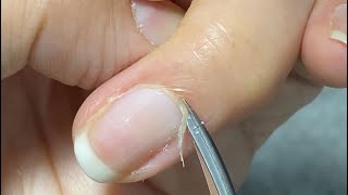 How to cut cuticles with scissors for cuticle carehow to use cuticle pusher and nipper [upl. by Aliakam]