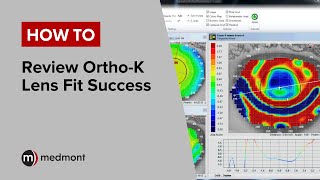 How To  Analyse OrthoK fit success Studio 6 [upl. by Nesahc146]