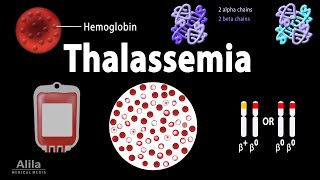 Thalassemia Alpha amp BetaThalassemias Genetics Pathophysiology Diagnosis amp Treatment Animation [upl. by Nimaj]