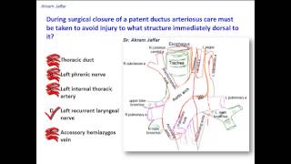 What structure is immediately dorsal to the ligamentum arteriosum [upl. by Tillion467]