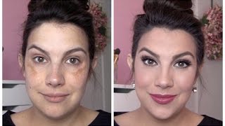 FULL COVERAGE Makeup for Melasma amp Discoloration [upl. by Waldron690]