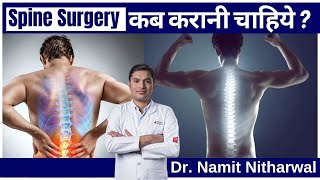 जानिये कब जरूरत पड़ती है Spine सर्जरी की  Indication for Surgery in Spine [upl. by Hermione]