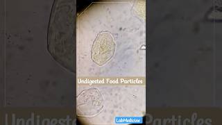 Undigested Food Particles  Stool Microscopy [upl. by Etiuqram]