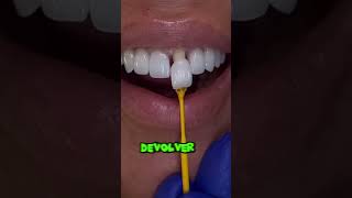 Los dientes más rotos se deben poner coronas dientes dentista tips parati viral fyp shorts [upl. by Hanna]