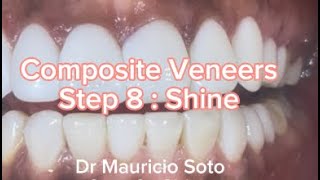 Composite Veneers Step 8 Shine [upl. by Aneev]