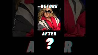 Jocelyn Wildenstein Before amp After celebrity rich gonewrong shorts [upl. by Midian]