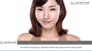 Grand Plastic Surgery Indonesia Real Story Perubahan Before  After [upl. by Ivz632]