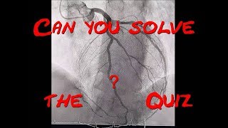 What are the Patient´s problems Echocardiography and Coronary angiogram Quiz by Cardiology Forum [upl. by Porcia]