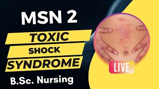 🚨 Toxic Shock Syndrome  MSN 2  BSc Nursing  Free Online Class [upl. by Aggy490]