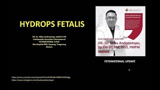 Hydrops Fetalis Dr Wiku Andonotopo [upl. by Nylacaj]