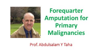 Forequarter Amputation for Primary Malignancies [upl. by Niltiac815]