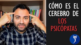 ¿Cómo es la mente de un psicópata ¿En qué se diferencia del resto [upl. by Aikit]