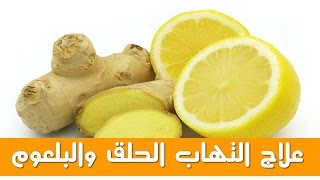 وصفة الدكتور جمال الصقلي لعلاج التهاب الحلق والبلعوم مجربة [upl. by Eimorej]