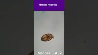 Fasciola hepatica ova 🤔😲 [upl. by Daren231]